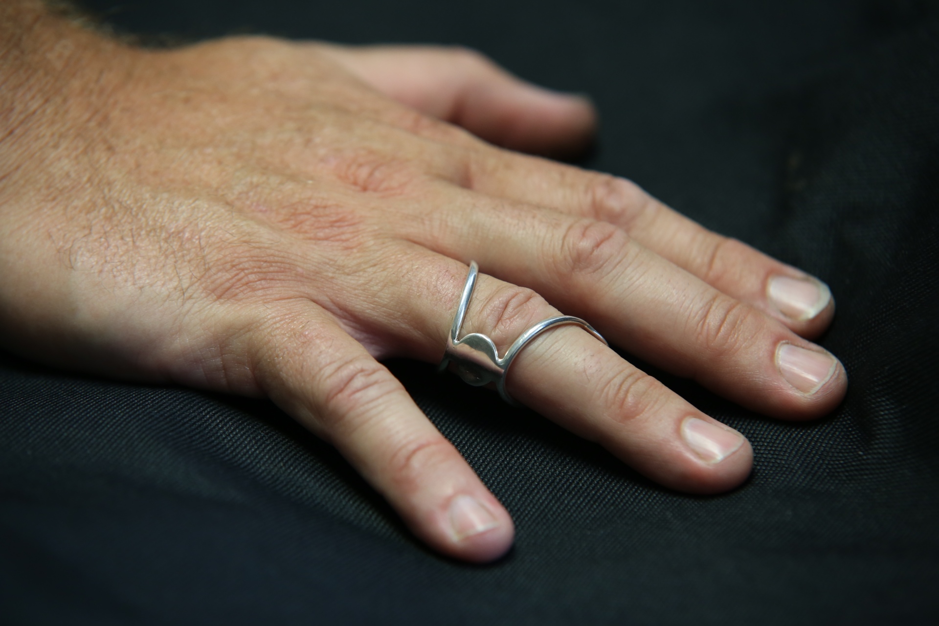 Re-alignment-splint-with-filled-spacer